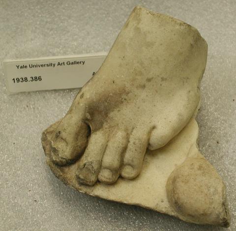 Fragment showing forward part of child's foot and toes